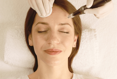 Microneedling